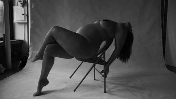 Wow! 5 Model Dunia Mengunggah Stretch Marksnya ke Instagram