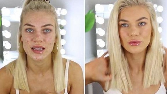 Ini Langkah Tepat untuk Memoles Riasan Make up pada Kulit Wajah Berjerawat