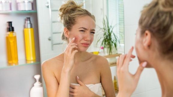 Mengenal Dermatitis Kontak, Alergi yang Bisa Kamu Alami Kalau Salah Pilih Skincare