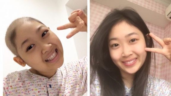 Cerita Gadis Pengidap Leukimia: Berhasil Lawan Kanker Selama 4 Tahun, Ternyata Ini di Balik Kesembuhannya