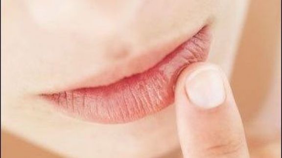 Bibir Sering Kering Selama Puasa? Coba 4 Tips Ini Biar Bibir Selalu Lembap!