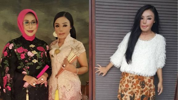 Kisah Inspiratif: Dulu Korban Penyiraman Air Keras oleh Suami, Kini Lisa Sukses Jadi Pengusaha Perhiasan, Salut!