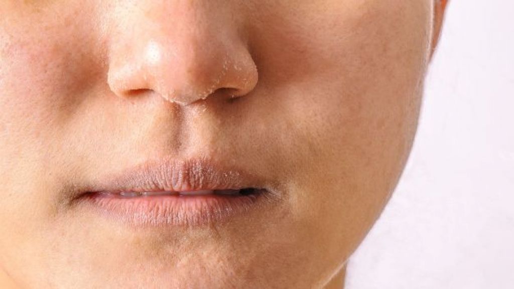 Gak Perlu Beli Lip Care Mahal! Cukup Manfaatkan 5 Bahan Alami Ini untuk Atasi Bibir Pecah-pecah, Masalah Langsung Hempas