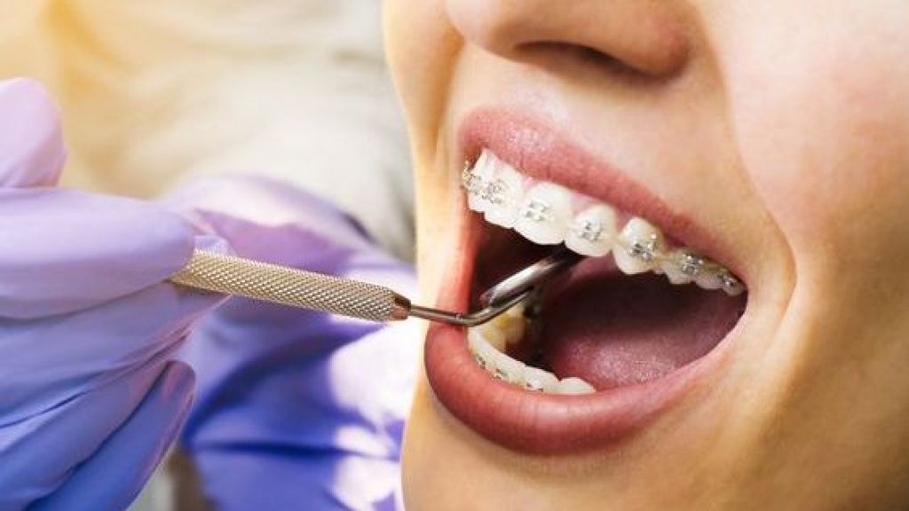 Gak Bisa Sembarangan, Kamu Ingin Berobat ke Dokter Gigi di Tengah Masa Pandemik? Harus Bikin Janji Dulu Lho!