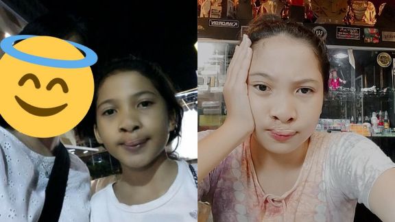 Kisah Inspiratif: Tepis Bullying Lantaran Bibir Sumbing, Gadis Ini Buktikan Lewat Segudang Bakat dan Prestasi
