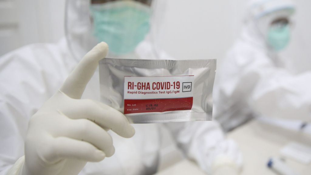 Sensitivitas Capai 98%, Rapid Test Corona Buatan Indonesia Siap Diproduksi Massal