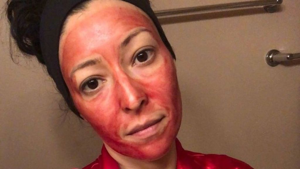 Viral! Wanita Ini Gunakan Darah Menstruasi untuk Masker Wajah, Ngaku Bikin Glowing
