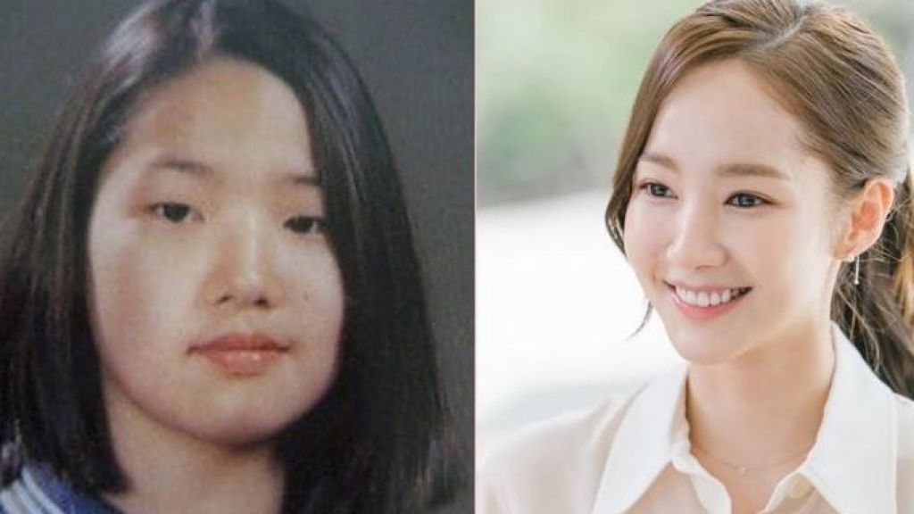 Dijuluki Queens of Surgery, 5 Transformasi Aktris Korea Park Min Young, hingga Sukses di Dunia Seni Peran