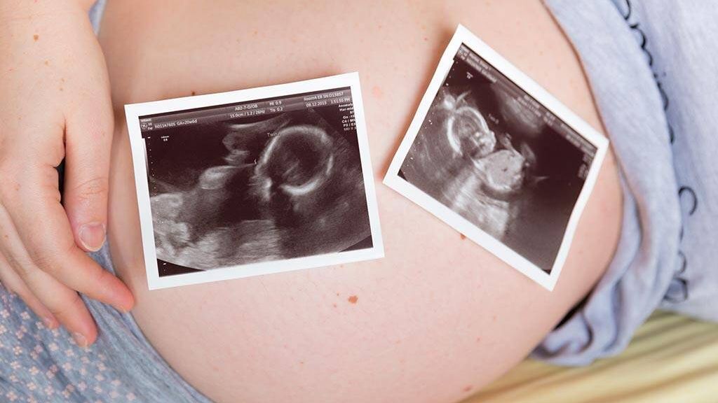 Calon Ibu Perlu Tahu, Ini Lho 7 Tanda Kalau Kamu Lagi Hamil Anak Kembar