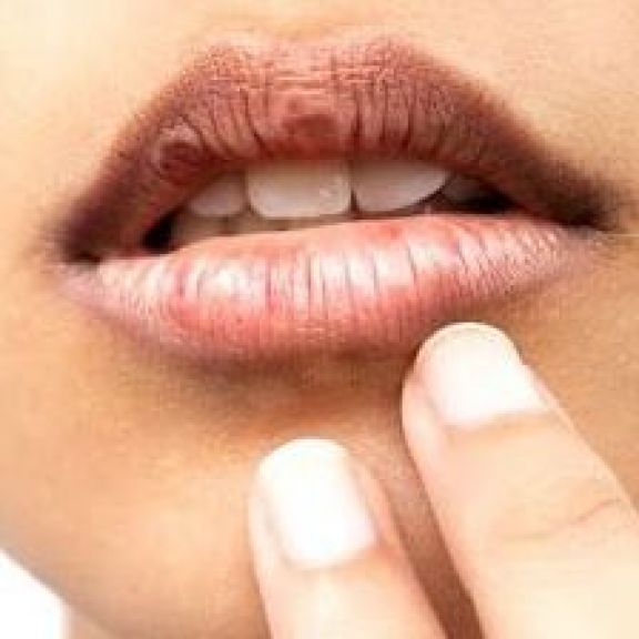 Makin Pede Gegara Bibir Merah Alami, Ini 6 Langkah Mudah Hempas Bibir Gelap! Cuss Langsung Buktikan Beauty!