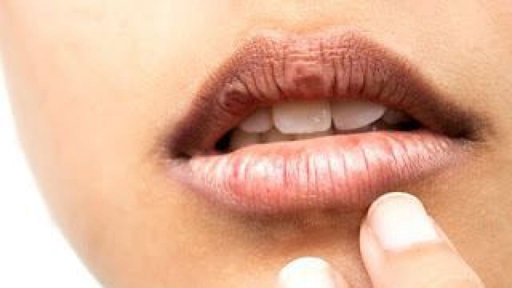 4 Kebiasaan Sepele yang Bikin Bibir Kering dan Pecah-pecah, Hindari Yuk!
