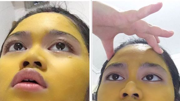 Viral! Wanita Ini Wajahnya Kuning Karena Masker Kunyit, Sebenarnya Boleh Enggak Sih Kunyit Jadi Masker?