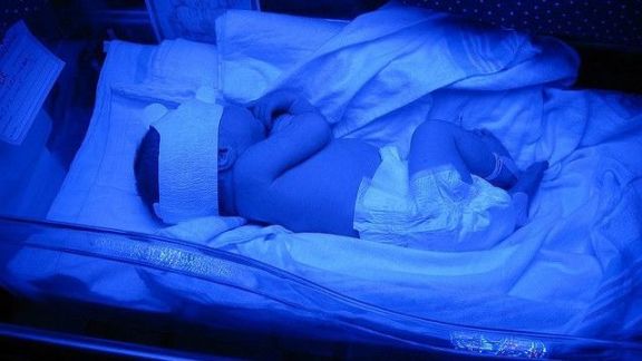 Berkaca dari Kasus Bayi Rizky Billar-Lesti Kejora, 4 Alasan Kenapa Bayi Prematur Harus Masuk Inkubator