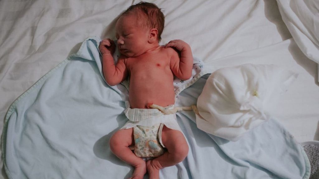 Kenali Omaphalitis, Infeksi Tali Pusar yang Sering Terjadi pada Bayi Prematur