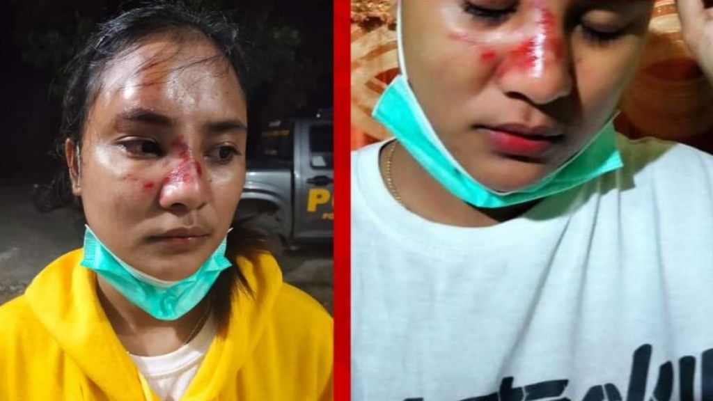 Cerita Sagita, Wanita yang Dipukul Satpol PP saat Razia Masker, Padahal Sudah Memakai Masker