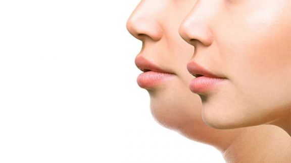 Beauty, Lakukan Ini Setiap Hari Untuk Hilangkan Double Chin!