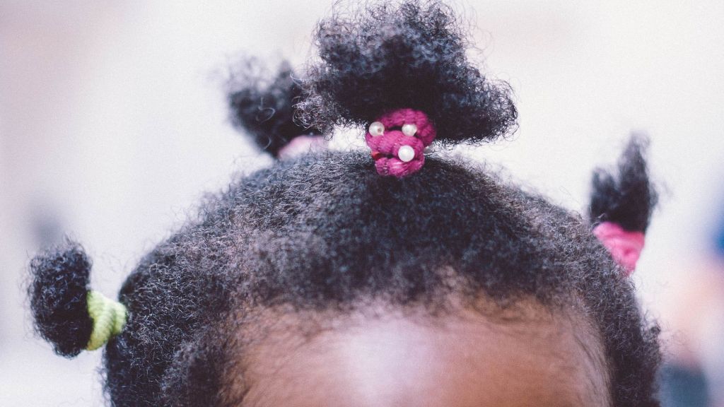 Moms, Sering Kuncir Rambut Anak? Jangan Terlalu Kencang Ya! Ini Bahaya yang Mengancam