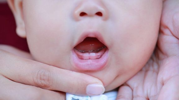 Anak Telat Tumbuh Gigi, Haruskah Moms Khawatir?