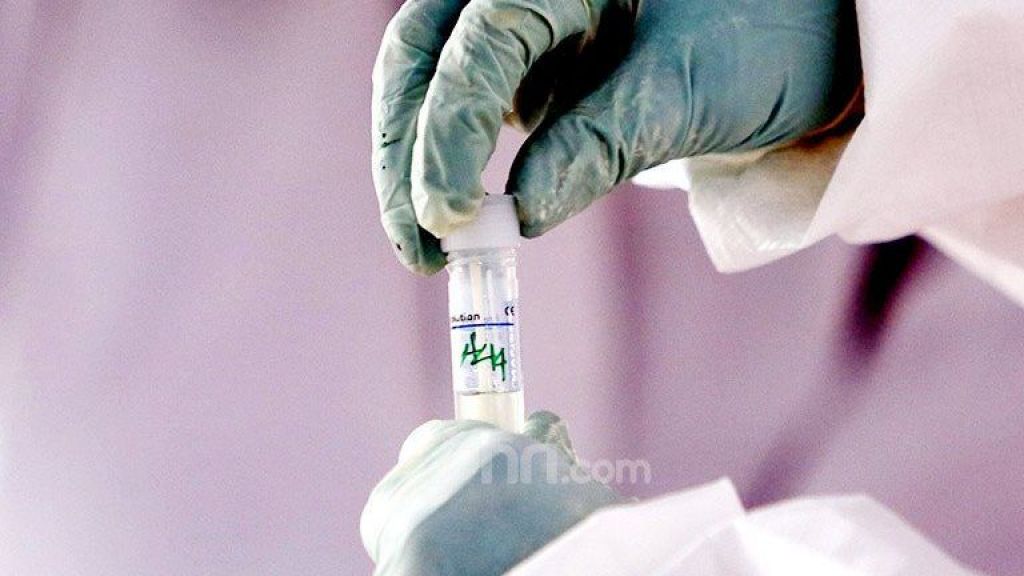 Mengobati Covid-19 di Rumah? Ini Tips dari Dokter Faheem, Cermati Ya!