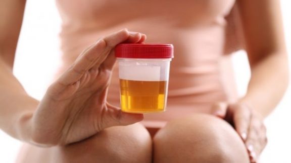 5 Tanda Ginjal Sedang Bermasalah, Kalau Urine Seperti Ini Bisa Jadi…
