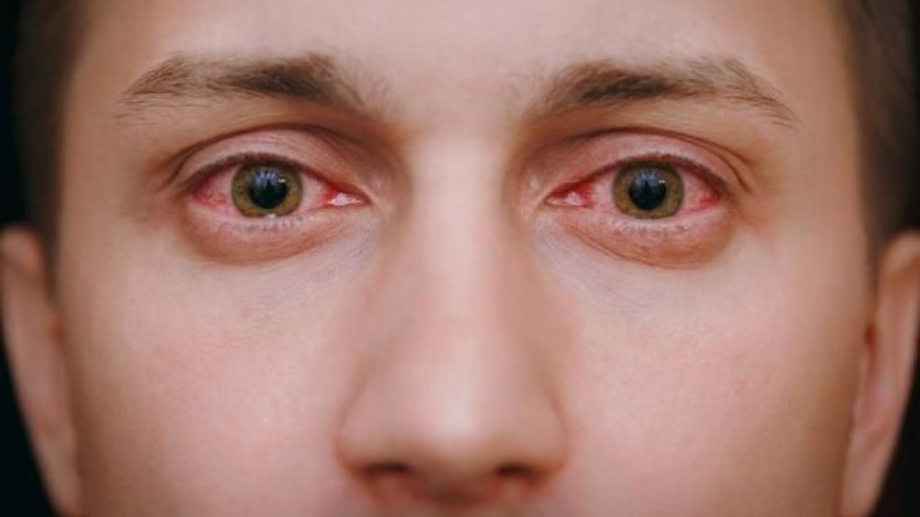 Bahaya Banget! Waspadai 7 Komplikasi Diabetes yang Terjadi pada Mata