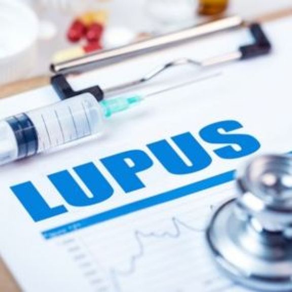Tiati Beauty, 3 Faktor Ini Bisa Tingkatkan Risiko Penyakit Lupus