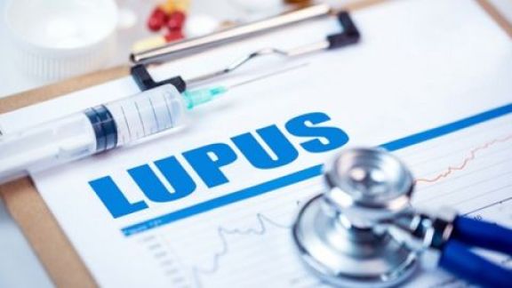 Pengobatan Penyakit Lupus: Apakah Pasien Bisa Sembuh Total?