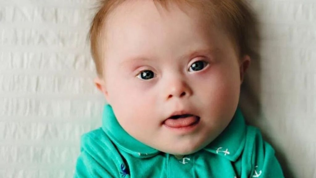 Hamil di Usia 35 Tahun ke Atas, Benarkah Akan Tingkatkan Kelahiran Anak dengan Kondisi Down Syndrome? Simak Yuk Moms!