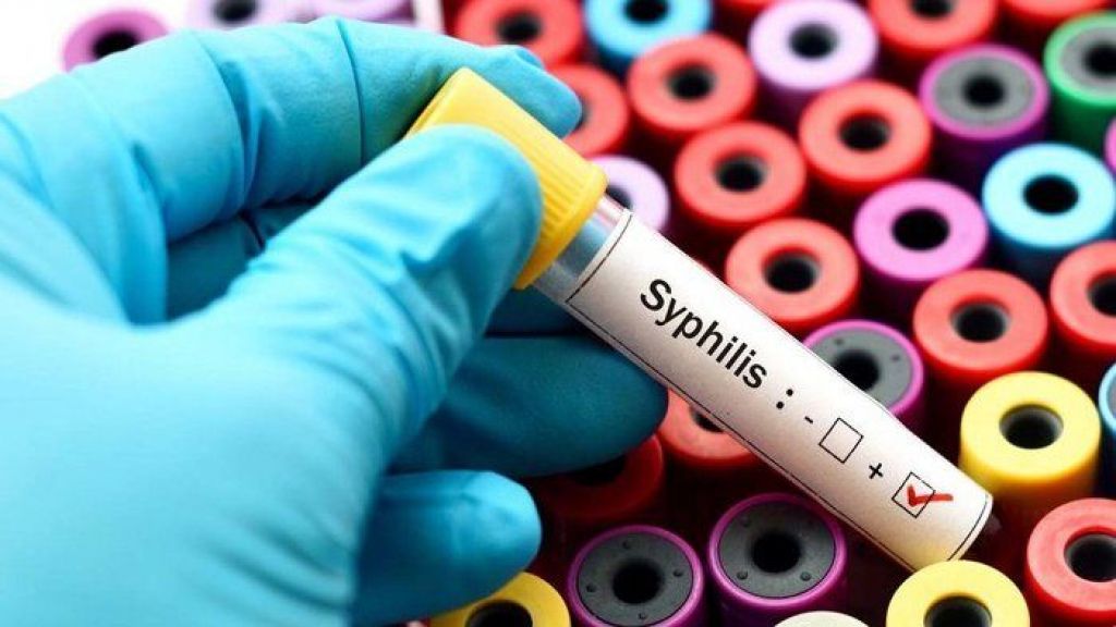 Indonesia Darurat Kasus Sifilis, Yuk Pasutri Kenali Penyebabnya dan Cara Mencegahnya di Sini, Penting!