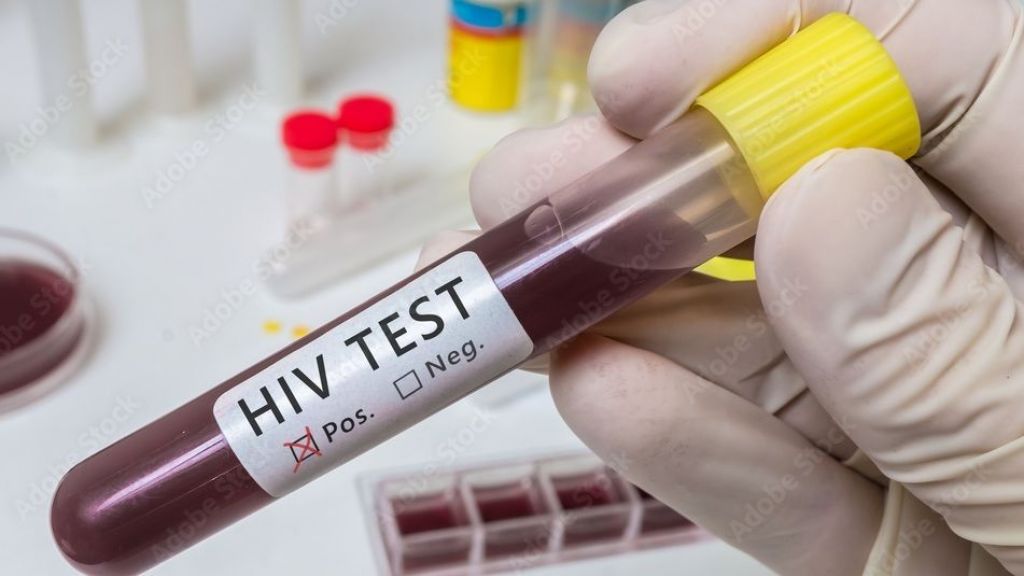 Baru Saja Bernapas Lega WHO Cabut Status Darurat Covid-19, Indonesia Terancam Epidemi HIV Gegara Kasus Sifilis Meroket, Waspada Moms!