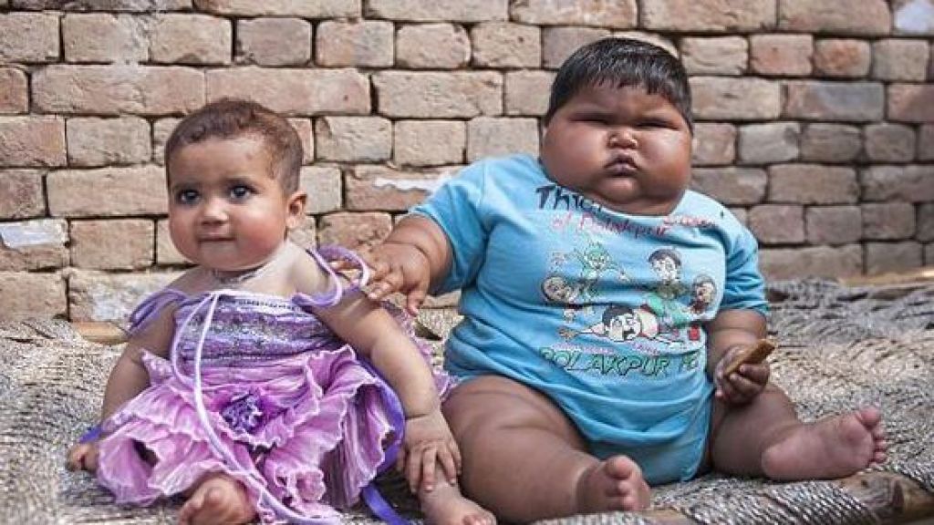 Kasusnya di Indonesia Makin Banyak, Ini 4 Cara Mencegah Anak Obesitas, Waspadai Kenaikan Berat Badan Tak Wajar Moms!
