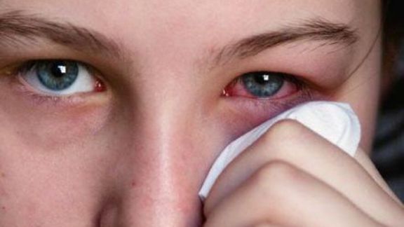 Tips Menjaga Kesehatan Mata di Tengah Paparan Polusi Udara yang Buruk, Harus Diterapin Nih Beauty!