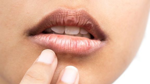 Bibir Kusam dan Pecah-pecah Hilang Seketika, Ini 3 Rekomendasi Lip Mask Ajaib Bikin Bibir Merah dan Plumpy, Hasilnya Kayak Pakai Lipstick!