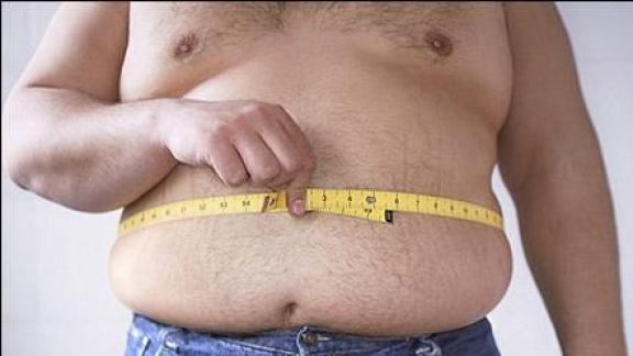 Berkaca dari Fajri yang Memiliki Bobot 300 Kg, Obesitas Jadi Pemicu Tulang Keropos Dini Nih Moms, Begini Kata Dokter Ahli