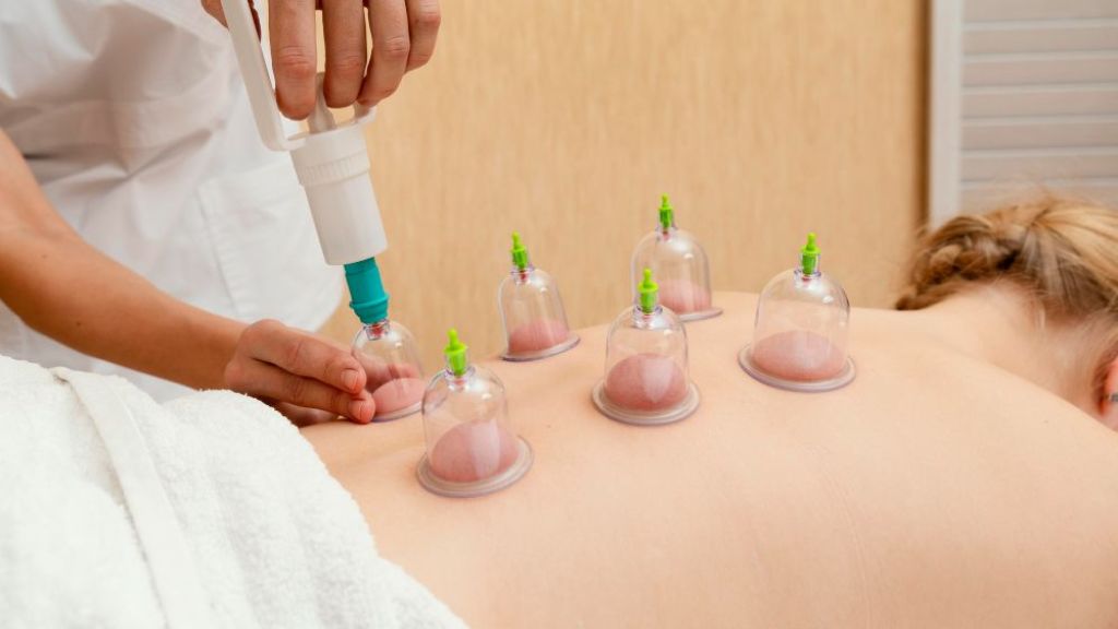 Mengenal Manfaat Bekam, Terapi ala Timur Tengah yang Bisa Keluarkan Racun dan Darah Kotor, Beauty Tertarik untuk Coba?