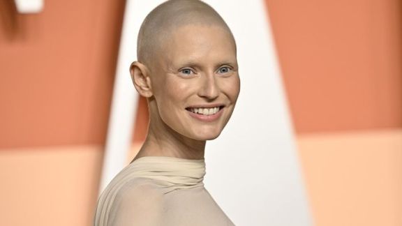 Tampil Percaya Diri, Bianca Balti Bersolek dengan Cantik di Red Carpet Pasca Kemoterapi dengan Kepala Botak