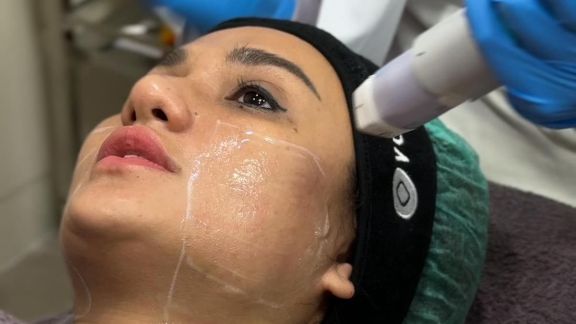 Tren Kecantikan Korea Menyapa Jakarta Lewat Klinik Premium, Intip Yuk Beauty!