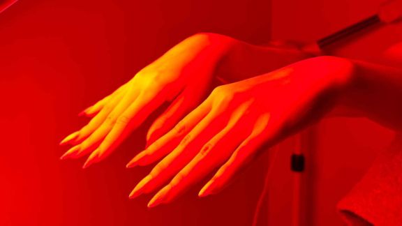 Treatment Tanpa Jarum, Tren Kecantikan Makin Diminati Lho!