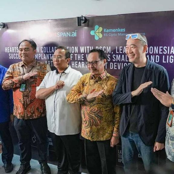 Harapan Baru Pasien Gagal Jantung, Kini Ada LVAD di Indonesia